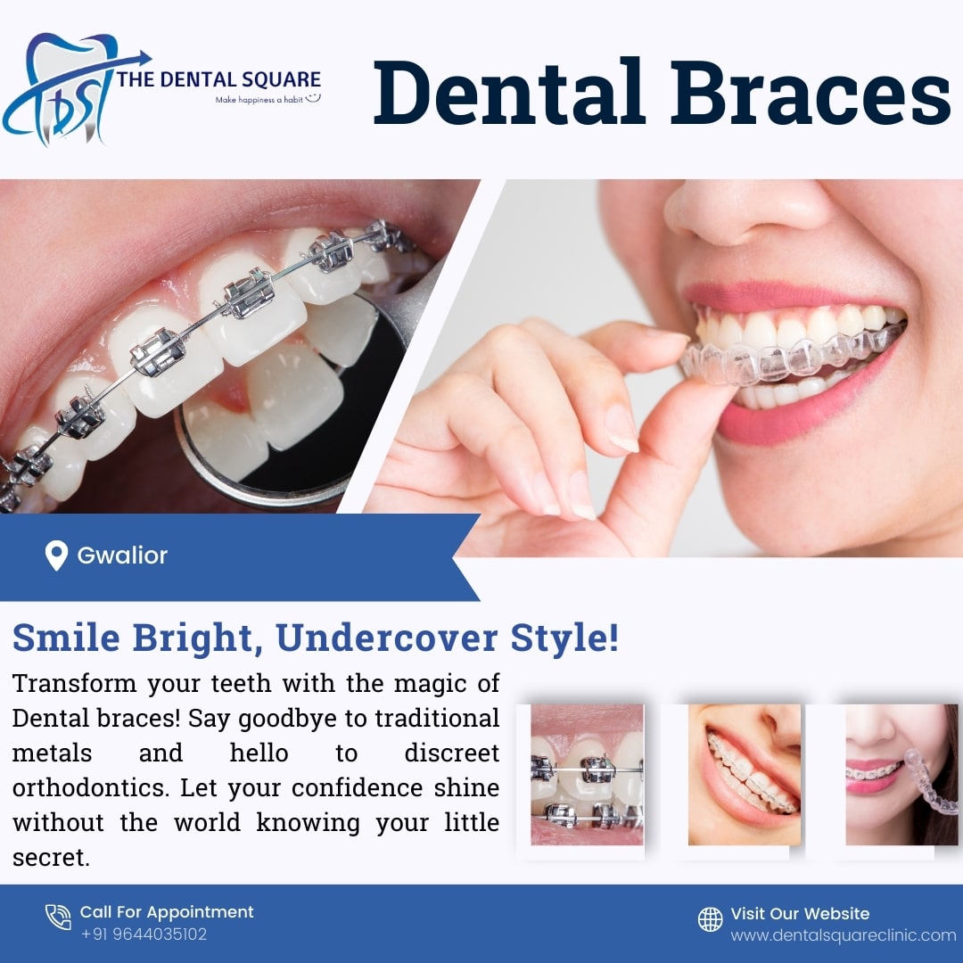 Dental Braces: Transforming Smiles Across Ages