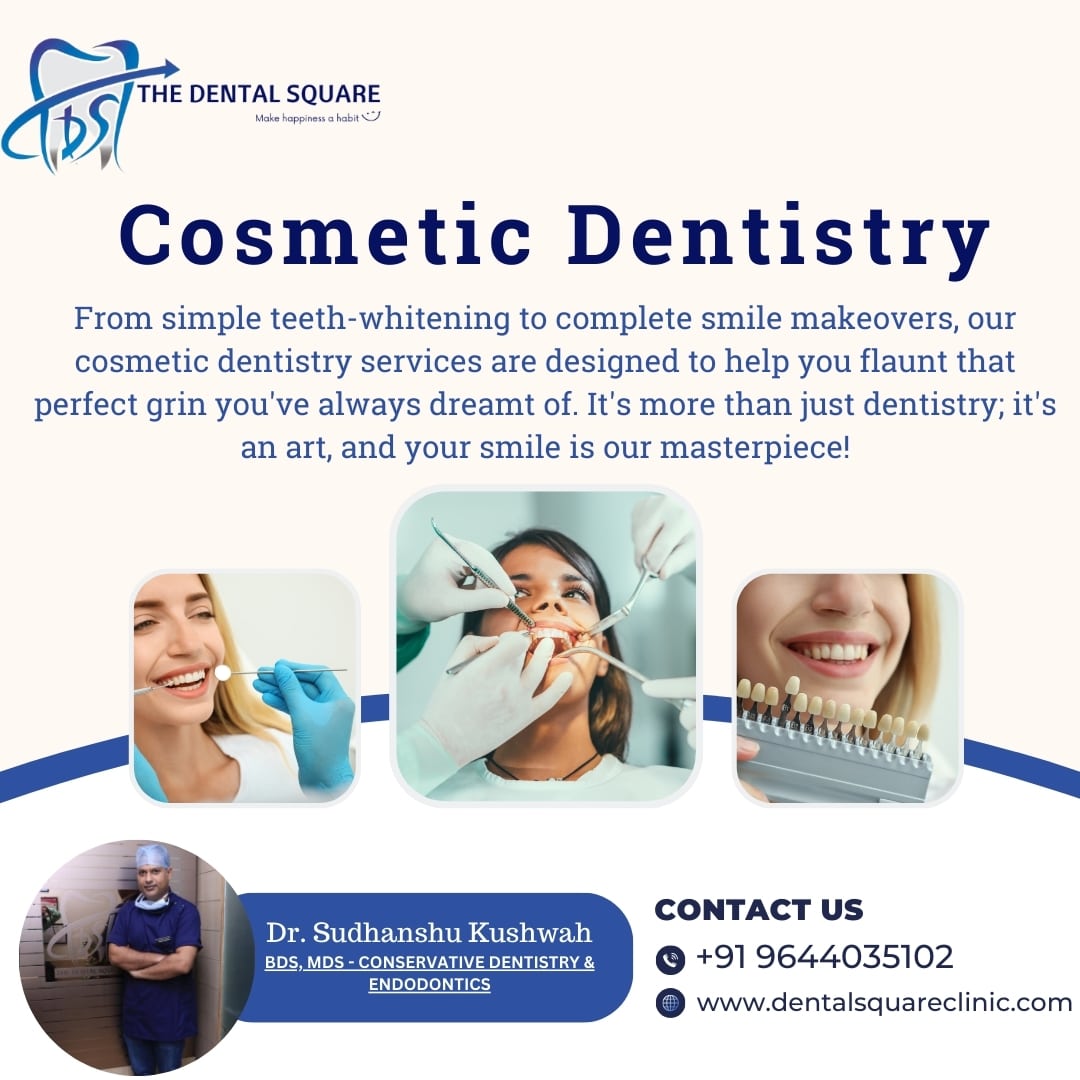 Cosmetic Dentistry – Enhance Your Smile with Modern Techniques