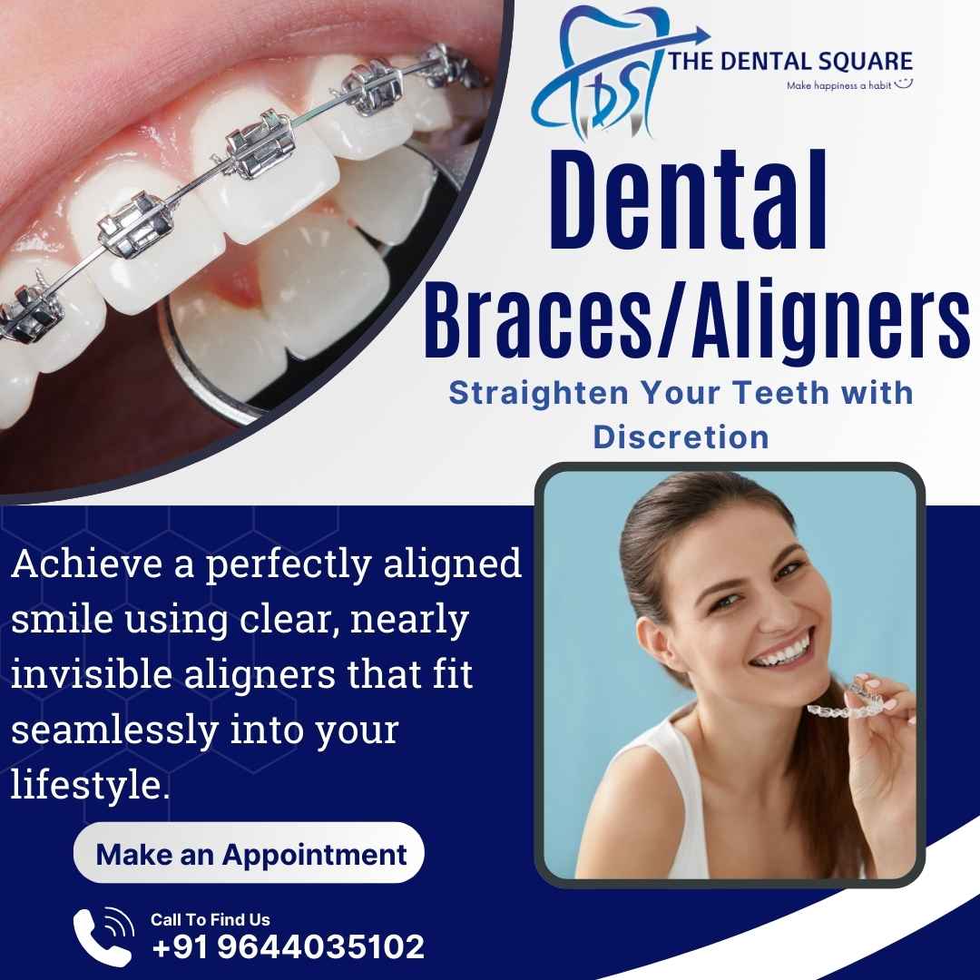 Dental Braces in Gwalior | Aligning Smiles with Expertise and Care