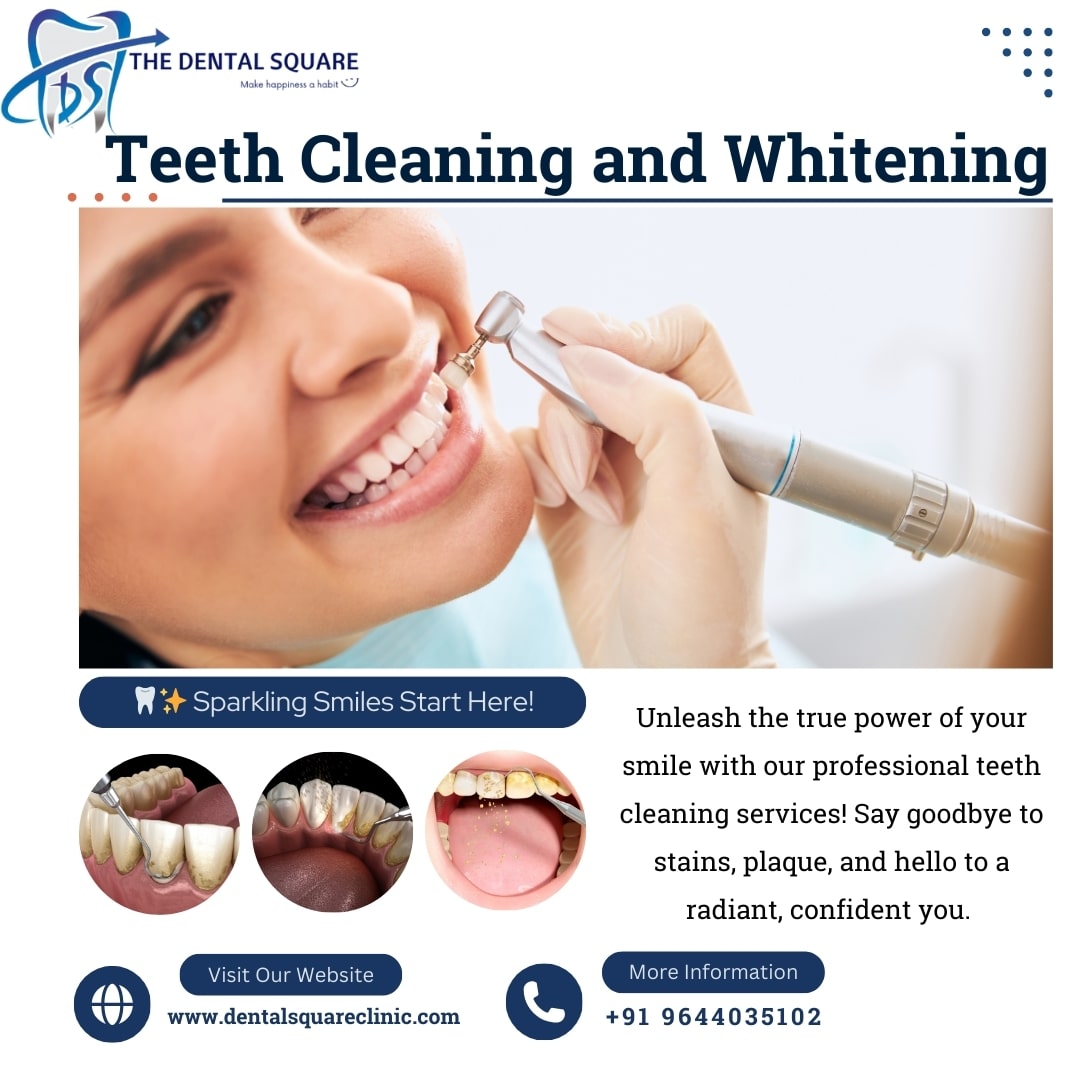 Teeth Cleaning and Whitening – Get Brighter Smile with Dr. Sudhanshu Kushwah