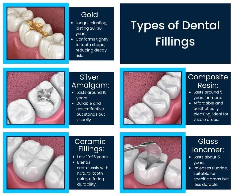 types-of-dental-fillings